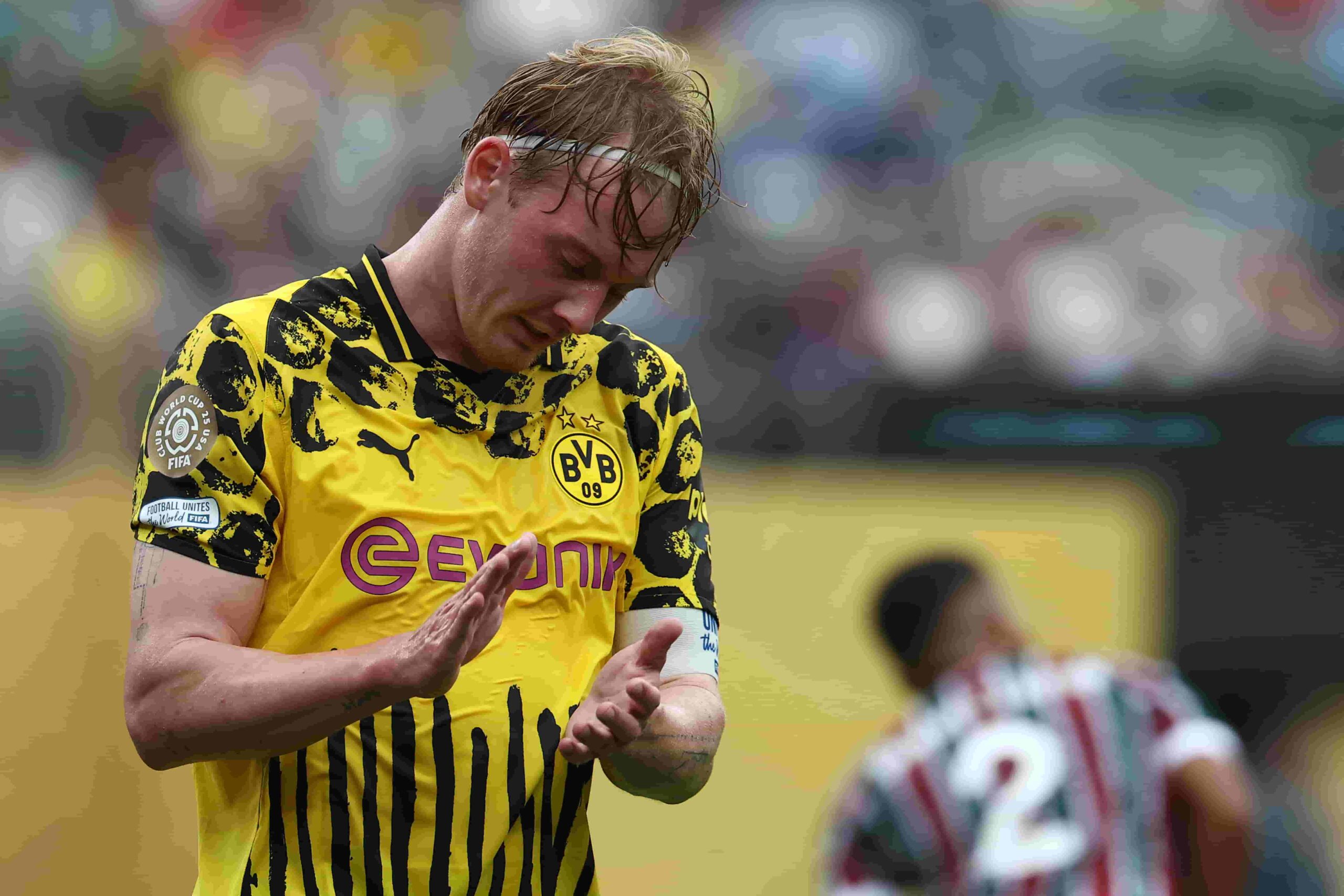 Brandt se fracturó su muñeca. Foto: Getty Images.